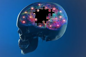 Insieme per il Parkinson: una nuova rete di collaborazione in Martesana