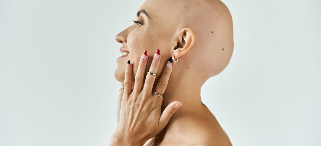 Alopecia cicatriziale: sintomi, cause, rimedi