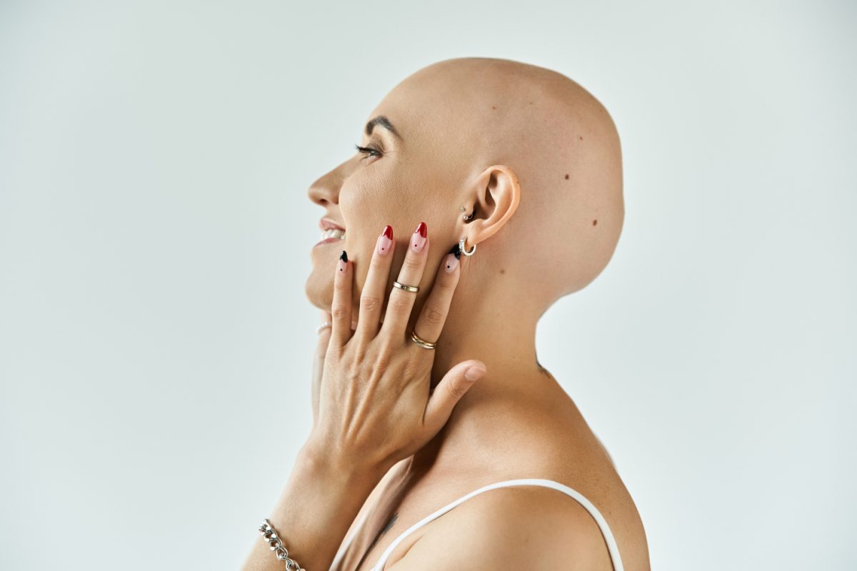 Alopecia cicatriziale: sintomi, cause, rimedi
